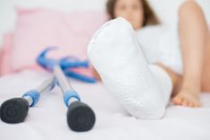Frau liegt mit einem Gipsbein im Bett
