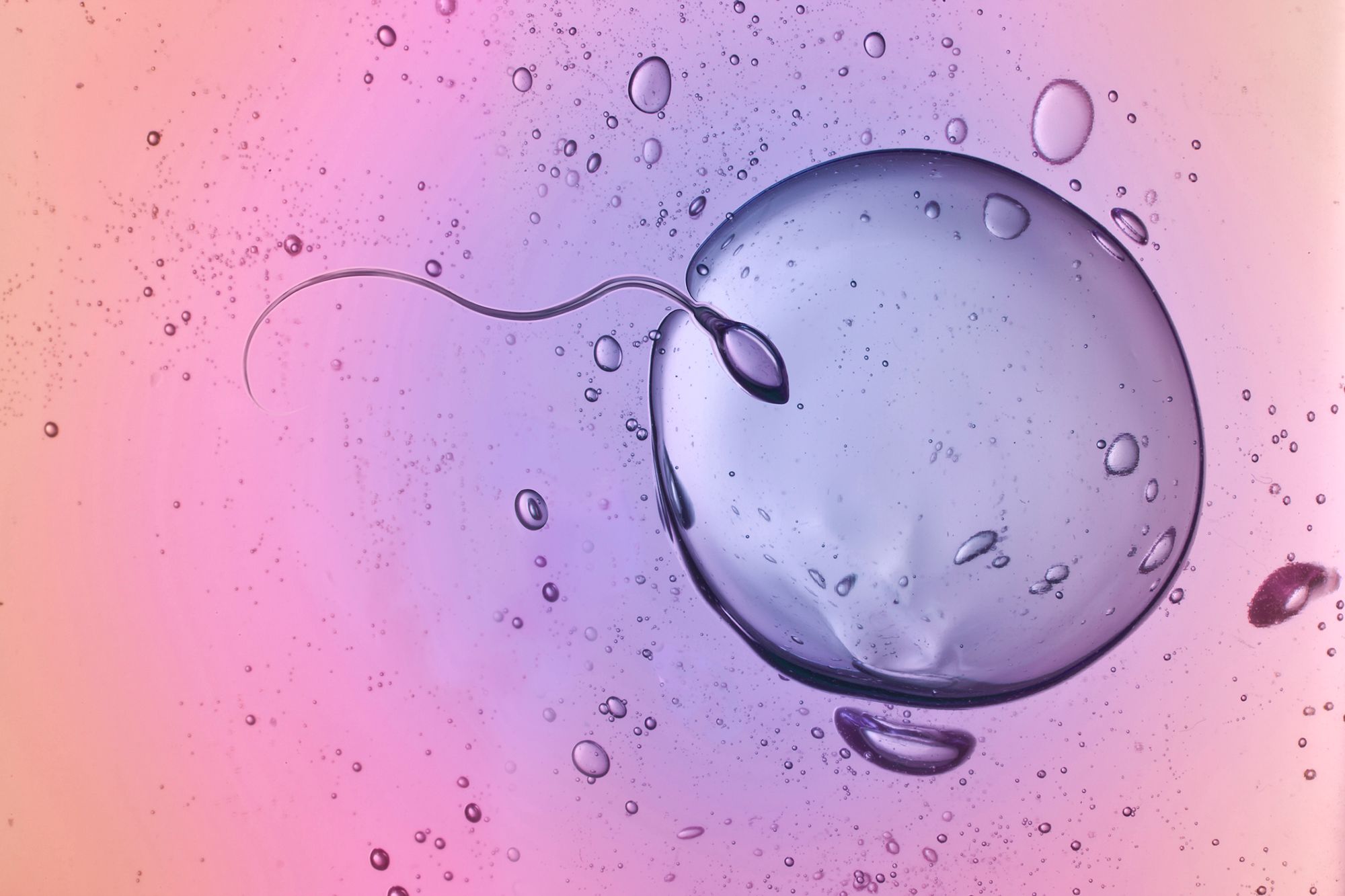 Das Bild zeigt eine mikroskopische Aufnahme, auf der zu sehen ist, wie ein Spermium eine Eizelle befruchtet.